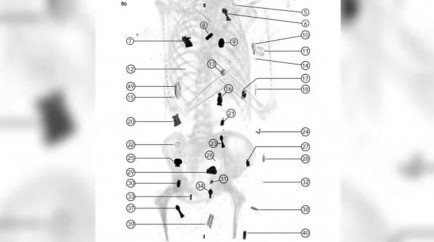 Los amuletos se colocaban sobre el cuerpo y se metan dentro de l