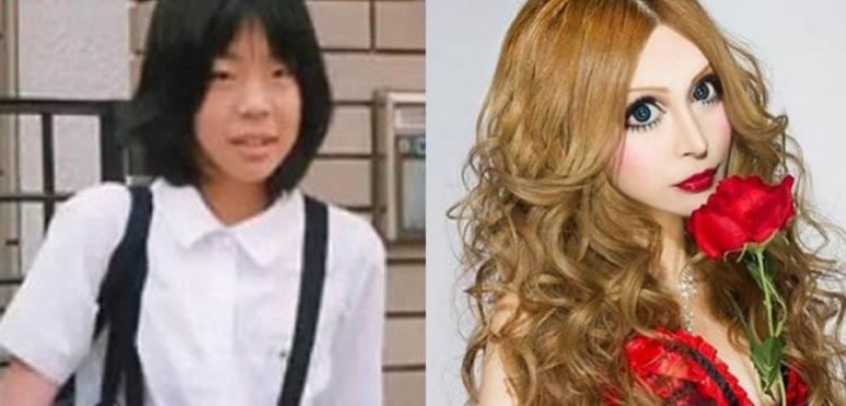 Una modelo japonesa invirtió más de 100 mil dólares en intervenciones estéticas para transformar sus rasgos asiáticos. Busca parecerse a una mujer occidental y lucir como una muñeca, porque