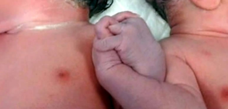 La tierna estampa que han protagonizado Daniel y Mara ha tenido lugar en un centro de Guipzcoa (ver video)