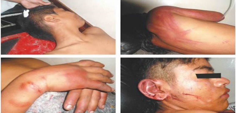 Los uniformados están acusados de haber golpeado y dejar en un basural a dos adolescentes de 15 años, uno de ellos inconsciente, en Orán.