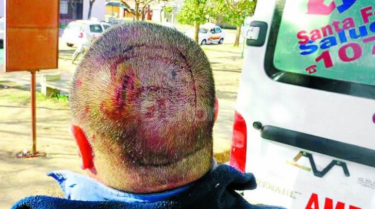 En el Samco. La mayoría de los trabajadores golpeados fue derivada al hospital Samco de Santo Tomé. Diez de ellos quedaron hospitalizados, uno con un “chuzazo” en sus glúteos. Muchos de sus compañeros tiene miedo que las agresiones continúen