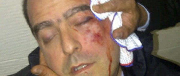Vuelven a agredir brutalmente a diputados opositores