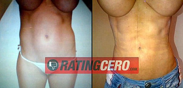 El antes y el despus de la ciruga esttica que se hizo Victoria Xipolitakis