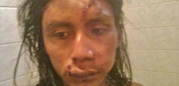 Golpearon salvajemente al hijo del cacique Qom en Formosa