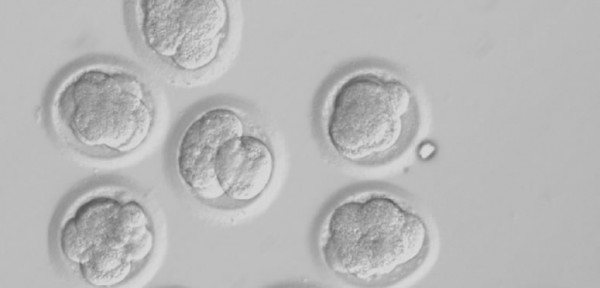 Cient�fico ruso se inyecta 'c�lulas eternas' halladas en Siberia