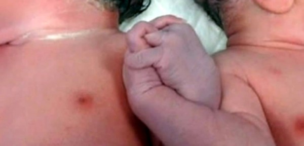 Dos mellizos se dan la mano al nacer