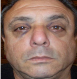 Exclusivo: Im�genes de un rostro golpeado en el Ministerio de Trabajo 