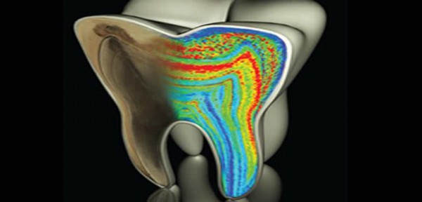 �Qu� esconden los dientes sensibles?