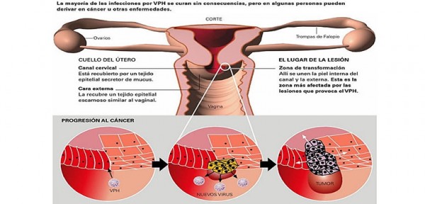 Hallan el mecanismo responsable del c�ncer de ovario