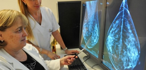 Muchas santafesinas no se hacen un control clave