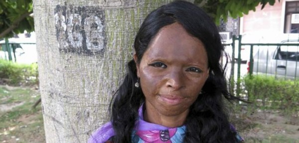 La historia de Laxmi, la joven que lidera la cruzada contra el �cido en la India