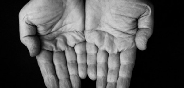 De locos: se operan la mano para 