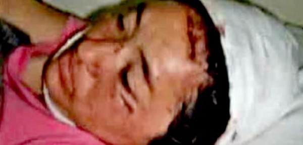 Ella le pidi� el divorcio y �l rompi� la cara a martillazos