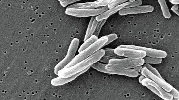 Streptococcus pyogenes: ya hay una muerte por día y se acelera la suba de casos