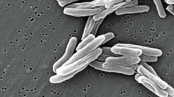 Streptococcus pyogenes: ya hay una muerte por da y se acelera la suba de casos