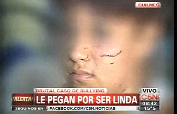Impactante video: as golpearon a la joven de Quilmes por ser 'linda'