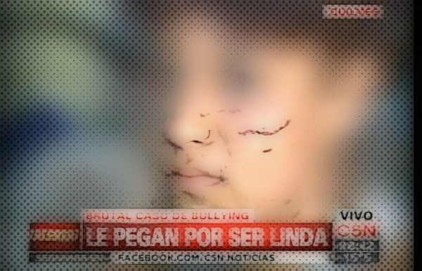 Habl la joven atacada brutalmente en Quilmes