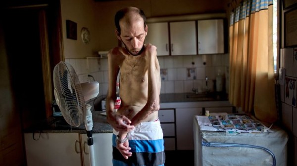 Argentina: mal uso de los agroquímicos provoca problemas de salud