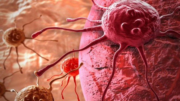 Cientficos destruyen el 99% de las clulas cancerosas mediante una nueva tcnica con 