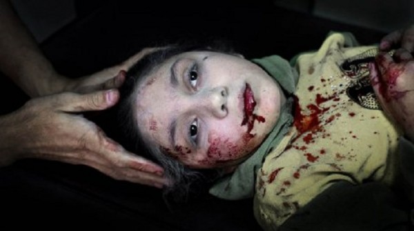 La mirada de una niña siria herida es