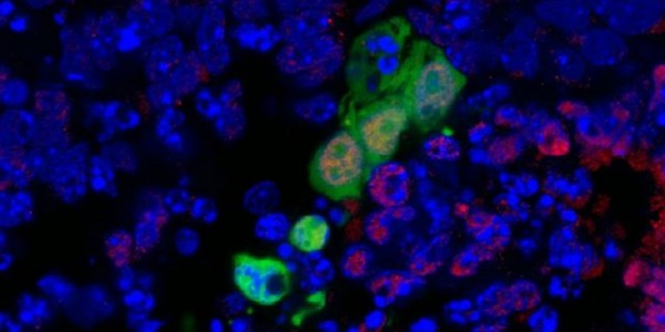 Un avance que permitir� cultivar �rganos humanos en animales