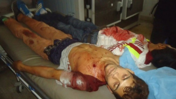 Al menos 13 muertos en dos jornadas de violencia en Venezuela