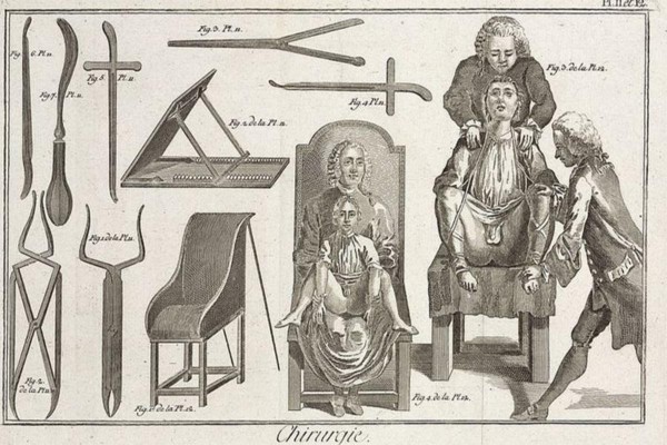 Los problemas de trasero de Luis XIV de Francia que dignificaron la ciruga (y dieron origen al himno de Inglaterra)