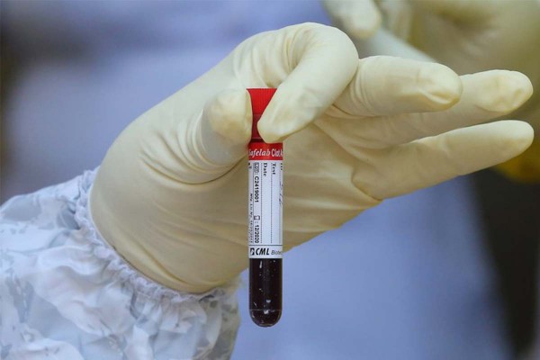 El coronavirus se siente particularmente atrado por un grupo sanguneo, sugiere un estudio