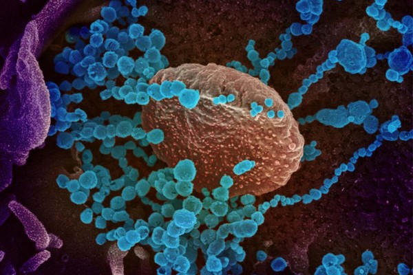 Cientficos de Sudfrica mantienen la vigilancia sobre una nueva variante del coronavirus