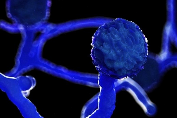 Hongo negro: 6 preguntas clave sobre la rara infecci�n f�ngica que ataca a pacientes de covid-19 en India