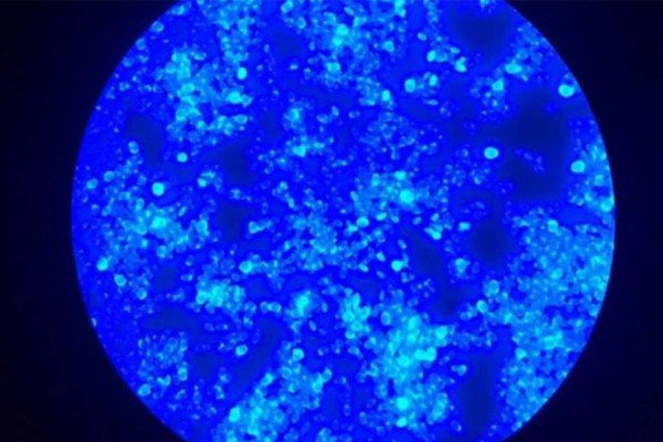 El super-hongo Candida auris avanza dentro de salas desbordadas con pacientes con COVID-19 en Brasil