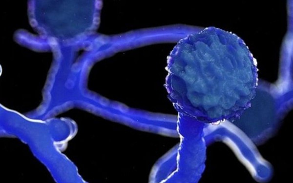 Hongo negro: la epidemia mortal contra la que luchan en los hospitales en India en medio de la pandemia de covid-19