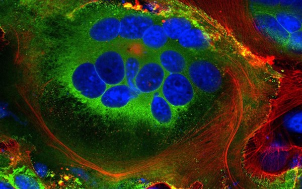 C�mo infecta el coronavirus las c�lulas y por qu� Delta es tan peligroso