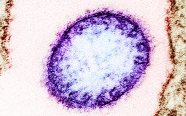 Por qu� el virus Nipah puede convertirse en 