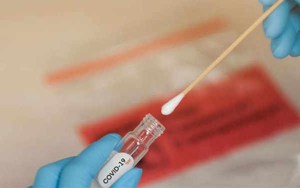 Testeos PCR: la Ciudad de Buenos Aires comienza a dar turnos por la alta demanda