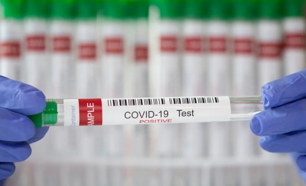 Test de COVID: es ms confiable el de saliva o el de hisopado por nariz?