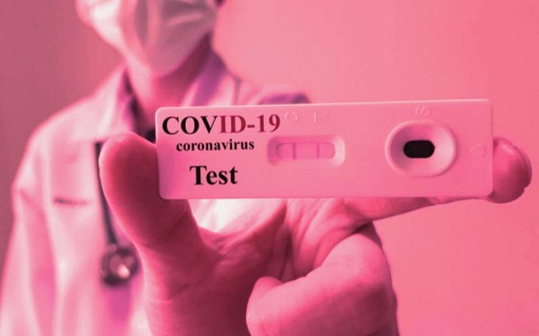 Llegan los autotest de coronavirus a las farmacias para su venta al p�blico