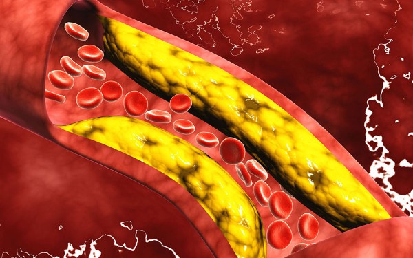 Cul es el alimento clave para reducir el colesterol, segn expertos de Harvard