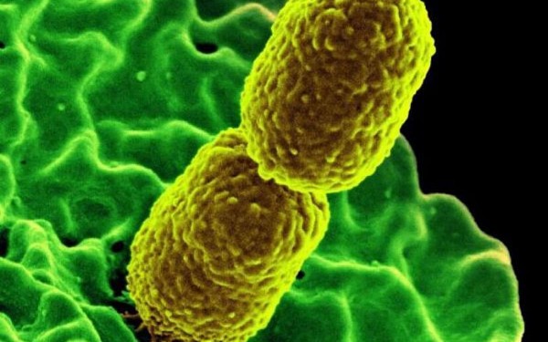 Por primera vez se detect� una superbacteria resistente a 30 antibi�ticos en pacientes de Argentina
