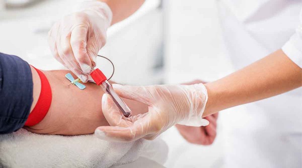 Detectar el c�ncer con una muestra de sangre: cu�les son los tests en estudio en el mundo