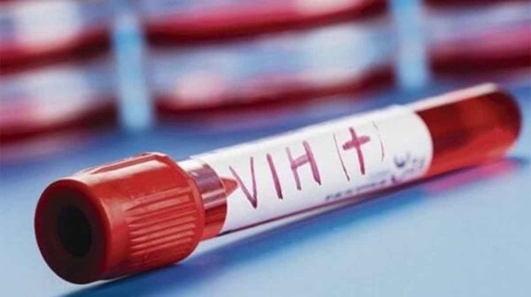 Se registr un nuevo caso de remisin del VIH tras un trasplante de mdula sea