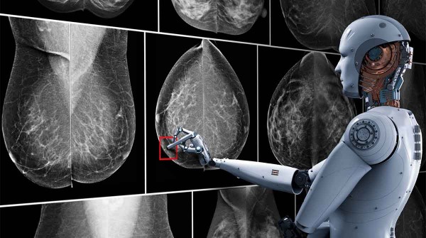 Cmo la IA puede detectar el cncer de mama, segn un nuevo estudio