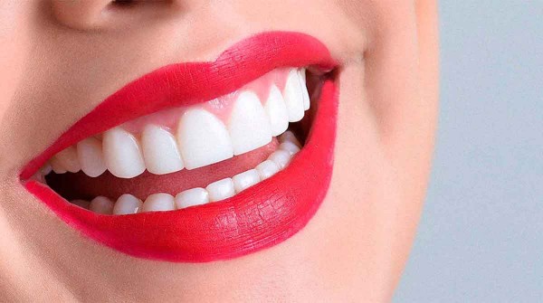 Alertan por los riesgos de la blancorexia, la obsesin por el blanqueamiento dental